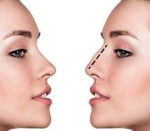 Slider image (8) High Profile